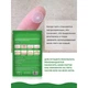 Точечные патчи от прыщей ELAIMEI Acne Pimple Patch 24 шт - изображение 4