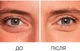 Многофункциональный стойкий консилер для лица L’Oréal Paris Infaillible More than concealer 328.5 Creme Brulee 11 мл (30153196) - изображение 7