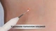 Электрокоагулятор для удаления бородавок и папиллом Meanersu MS-D02 от USB, 9 режимов (MS-D02) - изображение 4