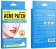Патчи против акне Sadoer Acne patch 36 шт (6942349709630) - изображение 2