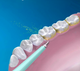 Скалер очиститель зубов от камня Dental Calculus Blue - изображение 10