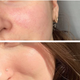 Крем для чувствительной кожи лица с розацеа Eco.prof.cosmetics by Dr.Vashchenko Cream 50 мл - изображение 2
