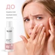 Тонер для лица RE.CARE Exfoliating Face toner Отшелушивающий 150 мл (4823109409217) - изображение 2