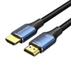 Кабель Vention Cotton Braided HDMI-A Male to Male HD v2.1 Cable 8K 2M Aluminum Alloy Type Black-Blue (ALGLH) - зображення 1