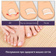 Пластирі для нігтів Elastic Toenail 50 pcs - зображення 5