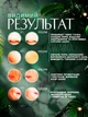 Аппарат для ультразвуковой чистки лица 6в1, скрабер, увлажнение и лифтинг, очищение, борьба с морщинами, массажер для лица, фонофорез, белый - изображение 4