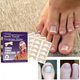 Набор пластырей для коррекции вростающих ногтей Elastic Toenail Correction Sticker (50 pcs) - изображение 4