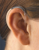 Слуховий апарат AUDIO SERVICE ASTRAL 12 S - зображення 3