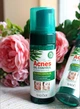 Очищающая пенка-мусс Sadoer Acnes для проблемной кожи и кожи с проявлениями акне 150 мл - изображение 1