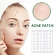 Патчі від прищів із зеленим чаєм sersanlove acne patch 72 штуки - зображення 4