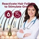 Миноксидил спрей для роста волос женщин Yzmoffer 5% Minoxidil Hair Growth Spray For Women 60 мл - изображение 2
