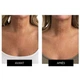 Набор CurrentBody Skin LED Light Therapy Face Neck Kit для лица, шеи и зоны декольте - изображение 6