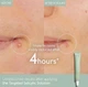 Крем точечного нанесения для быстрого устранения прыщей Caudalie Vinopure Stop Boutons Salicylique 15 ml - изображение 3