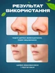 Щетка массажер для чистки умывания лица двухсторонняя BRS White - изображение 5