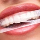 Отбеливающие полоски AIMED Teeth Whitening Strips 28 шт на 14 процедур Вкус Мята (AI-TWS28_mint) - изображение 9