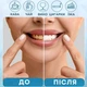 Набор гелей для отбеливания зубов AIMED Smile Gel 2 мл х 3 шт (7970379617630) - изображение 2