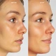 Крем мгновенного осветления пятен со стабилизированным витамином С Lancer Instant Brightening Booster 7.5 ml - изображение 3