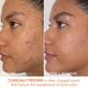 Кислотный пилинг Dr.Dennis Gross Alpha Beta Peel Extra Strength Formula (в наборе 3 пластины по 2 салфетки) - изображение 3