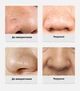 Очищуюча маска для обличчя Lanbena Nose Plants Pore 30 г для видалення чорних точок та вугрів 29249 - зображення 6