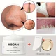 Очищуюча маска для обличчя Lanbena Nose Plants Pore 30 г для видалення чорних точок та вугрів 29249 - зображення 7