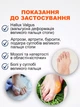 Вальгусный корректор для большого пальца при вальгусной деформации силиконовый для снятия боли фиксатор - изображение 3