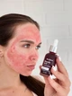 Кислотная сыворотка-пилинг для лица HOLLYSKIN Glycolic Acid 30мл - изображение 4
