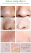 Жидкая маска Lanbena Blackhead Remover Mask NO.1 с растительными экстрактами 17 мл + 100 бумажных пластин (6970470536115) - изображение 6