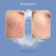 Салициловый пилинг Health Peel 20% pH2.0 30 мл (4820208890229) - изображение 7