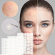 Патчі від прищів та акне 72 шт / Пластир косметичний для лікування акне Acne Patch (L) - изображение 5