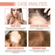 Лосьйон для росту волосся з грейпфрутом Eelhoe Grapefruit Thicker Hair Growth Lotion, 100 мл - изображение 5