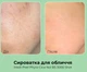 Сыворотка-пилинг со спикулами Medi-Peel Phyto Cica-nol B5 3,000 Shot Serum 50мл - изображение 3