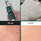Сыворотка пилинг со спикулами для восстановления кожи Medi-Peel Phyto Cica-nol B5 3000 Shot Serum 50 ml - изображение 4