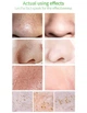 Маска-сыворотка для удаления черных точек глубокая очистка LANBENA Blackhead Remover Mask №1 17 ml с бумажными полосками - изображение 7