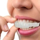 Знімні вініри для зубів Veneers smile, накладні зуби верх і низ у кейсі - зображення 2