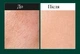 Пилинг-сыворотка со спикулами для чувствительной кожи лица Medi-Peel Phyto Cica-Nol B5 3000 Shot Serum 50 ml - изображение 3