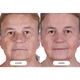 Светодиодная маска CurrentBody Skin LED Light Therapy Face Mask: Series 2 нового поколения - изображение 7