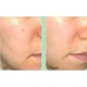 Балансуюча ампульна сироватка для обличчя з чайним деревом Medi-Peel Dutch Tea A.C Calming Serum, 70 мл - зображення 4