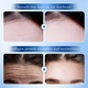 Патч гідрогелевий для лоба SADOER Collagen Hyaluronic Acid Forehead Patch, патч від зморшок для чола, 10 г - зображення 5