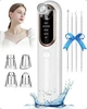 Професійний вакуумний очисник пор для видалення чорних цяток Yccu Blackhead Remover Y002 - изображение 1