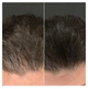Засіб для відновлення Волосся CALECIM Pro Advanced Hair System 6 ампул по 5 мл - зображення 7