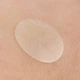 Точечные наклейки-патчи от акне ночные LANBENA Acne Pimple Patch Night Use (28 шт) - изображение 5