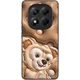 TPU+PC чохол Prisma Fluffie для Xiaomi Redmi Note 14 Pro 4G Dream - зображення 2