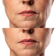Микротоковый RF Lifting Массажер для лица Skin Lifting 7.0 Pink - EMS, LED - изображение 4