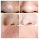 Маска для удаления черных точек LANBENA Blackhead Remover Mask NO.1 17 мл + 100 бумажных пластин 6970470536115 - изображение 2