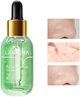 Сироватка для звуження пор Lanbena Pore Minimizer Serum NO.2 17 ml 6970470536122 - зображення 1