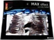 Твистер Siko Mini Max 35 мм 20 шт Прозрачный (SL01535P013) - изображение 2
