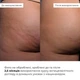 Курс антицеллюлитного ухода в домашних условиях с ниацинамидом Hillary Niacinamide Anti-Cellulite Home Care K2-11-564 - изображение 2