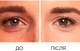 Консилер для лица L'Oreal Paris Infaillible More Than Concealer 324 Cool 11 мл (30173590) - изображение 3
