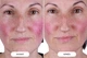Светодиодная маска CurrentBody Skin LED Light Therapy Face Mask: Series 2 нового поколения - изображение 4