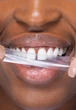 Отбеливающие полоски для зубов SmileKit PAP+ 28 шт (5.151) - изображение 6
